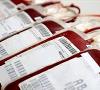اهدای خون درهفته نخست رمضان کمتر از نیاز بود