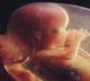 صدور مجوز سقط جنین درمانی بدون رضایت پدر