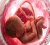 مهم ترین عامل سقط جنین را بشناسید!
