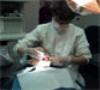 سمنت دندانی، جایگزین کشیدن دندان های پوسیده