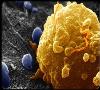 تشخیص سلول‌های سرطانی تهاجمی از خوش‌خیم با نانو حسگر ایرانی