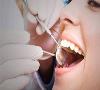 تاثیر جرم دندان بر سکته مغزی و قلبی