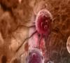 توقف رشد سلول سرطانی با کمپلکس نانودارویی ساخت محققان دانشگاهی