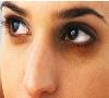 چند روش برای از بین بردن سیاهی دور چشم