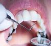 ایجاد شبکه جامع اطلاعات ملی دندانپزشکی