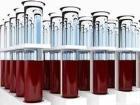 محققان دانشگاه ورمونت موفق به کشف دو پروتئین جدید در سلول‌های قرمز خون شده‌اند که می‌تواند وجود دو نوع جدید از گروه خونی قابل آزمایش را به اثبات برساند.