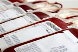 سخنگوی سازمان انتقال خون گفت : اهدای خون در هفته نخست ماه رمضان کمتر از متوسط روزهای عادی سال و کمتر از میزان مورد نیاز بود .
 
 
