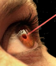 

عمل جراحی لیزیک ( LASIK) بر روی چشم‌ها انجام می‌شود تا دید آنها را بهبود بخشد و اغلب نیاز به استفاده از عینک یا لنز تماسی را برطرف می‌‌کند.
