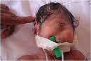 منابع بیمارستانی در عراق روز سه شنبه اعلام کردند یک نوزاد یک چشم در بیمارستانی در شهر الناصریه در سیصد و هفتاد و پنج کیلومتری جنوب بغداد متولد شده است.

