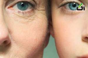 در پیری زودرس پوست 3 عامل اصلی وجود دارد . این عوامل عبارتند از :