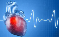 حمله قلبی یک باره اتفاق نمی افتد، بلکه همراه با علایم متعددی است که طی روزها و هفته ها خود را نشان می دهد اما اغلب افراد به آن بی توجهند. علایم حمله قلبی مختلف و در زنان و مردان متفاوت است.