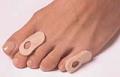 ميخچه‌ها، پينه‌هاي دردناكي هستند كه روي انگشتان پاها در اثر سايش، راه رفتن زياد و پوشيدن كفش‌هاي نامناسب و ناراحت شكل مي‌گ