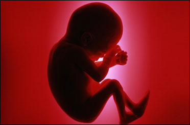پژوهشگر ایرانی دانشگاه بوستون می گوید مصرف داروهای مسکن در ماه های اول بارداری می تواند موجب نقص در لوله عصبی جنین شود.