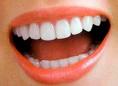 مهمترین ایجاد عامل پوسیدگی دندان و بیمارهای لثه پلاک میکروبی است که در روی سطوح دندانی تجمع می‌یابد