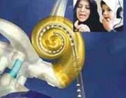 تهران - معاون درمان وزارت بهداشت، درمان و آموزش پزشكي گفت: سالانه 400 تا 500 عمل جراحي كاشت حلزون شنوايي در كشور انجام مي شود.
