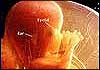 رئیس دانشگاه علوم پزشکی شهیدبهشتی گفت: احتمال سقط جنین در خانمهای سیگاری 80 درصد بیشتر از سایر افراد است.