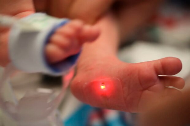 محققان نوعی حسگر نازک از جنس سیلیکون ابداع کرده اند که به پوست نوزاد بیمار می چسبد و به طور بی سیم علائم حیاتی او را رصد و به رایانه ارسال می کند.