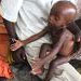 کودکان کنیایی به علت خشکسالی و قحطی در معرض سوء تغذیه شدید قرار دارند.
