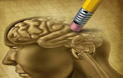 بیماری آلزایمر به علت زوال مغزی و آسیب دیدن سلول‌های عصبی رخ می‌دهد.